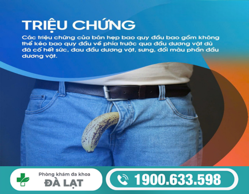 Hình ảnh minh họa